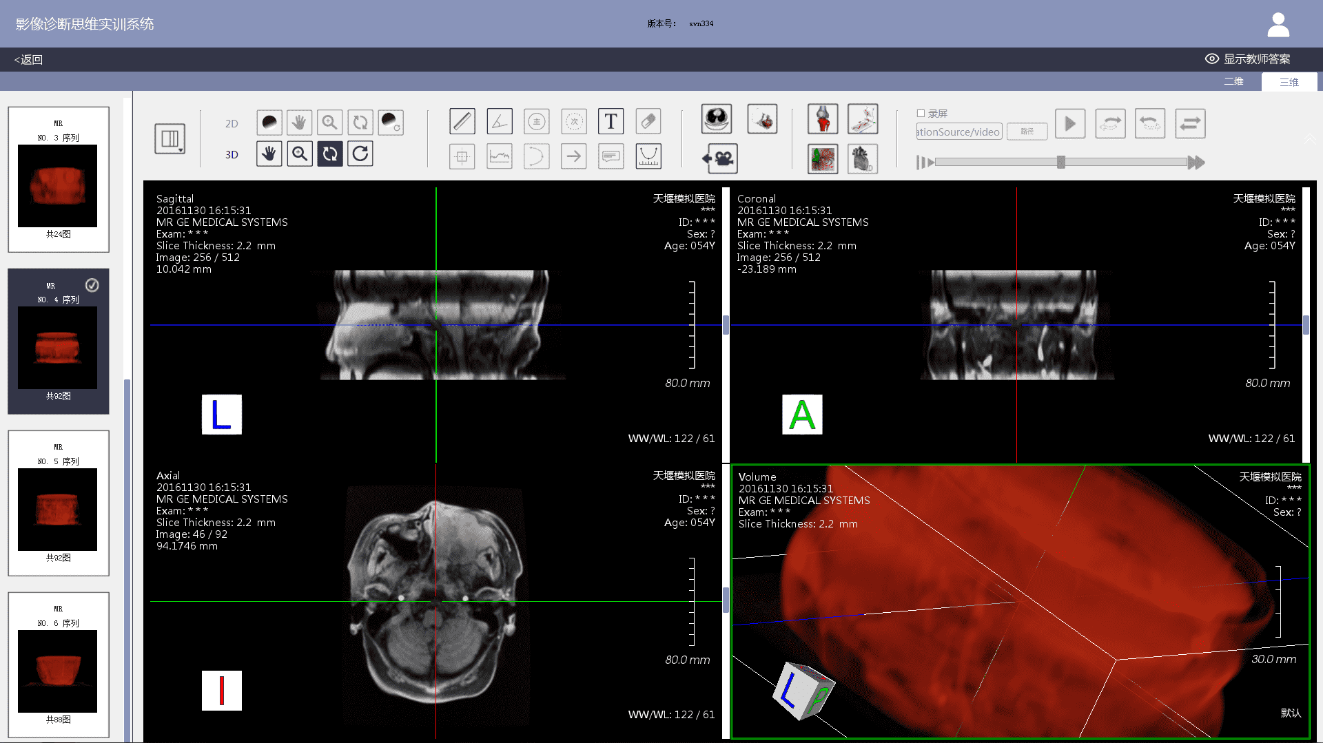 Image Diagnostic Thinking Training System